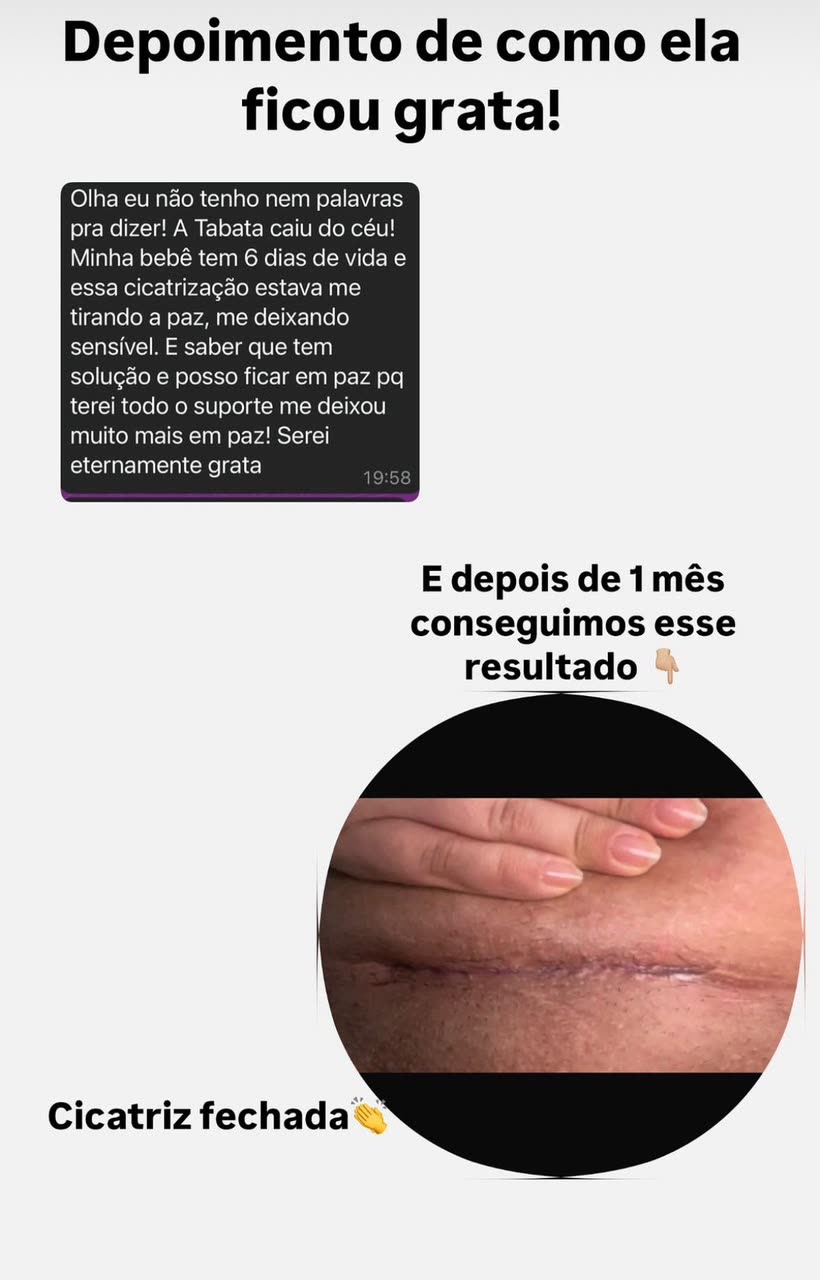 Print de depoimento: mãe com bebê de 6 dias agradece o suporte da Tabata; depois de 1 mês, cicatriz fechada